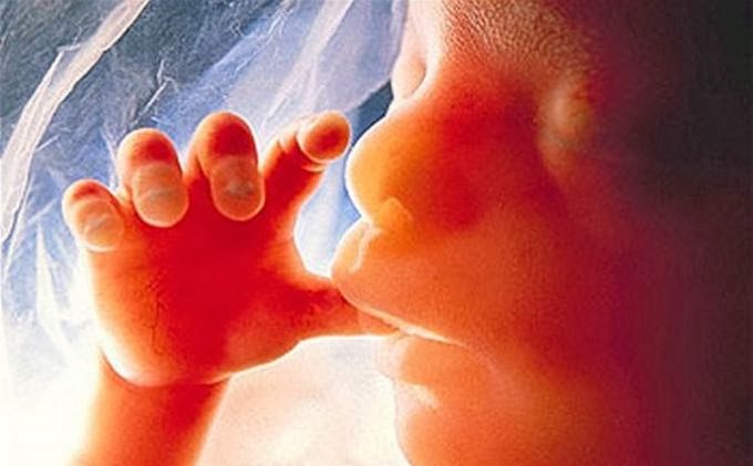 “Η άμβλωση, θεωρείται και δείγμα ανελευθερίας”