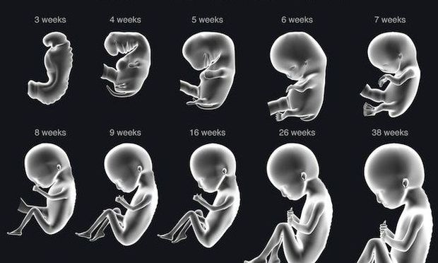 “Εκτρώσεις-μία μορφή γενοκτονίας”