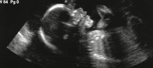 Churches should promote value of women to combat India’s gender abortion, says charity