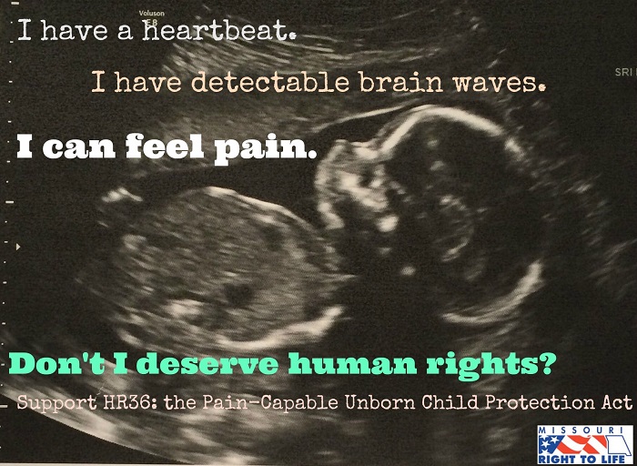 Η ΦΩΤΟΓΡΑΦΙΑ ΤΗΣ ΗΜΕΡΑΣ: Μία ερώτηση για το αγέννητο παιδί