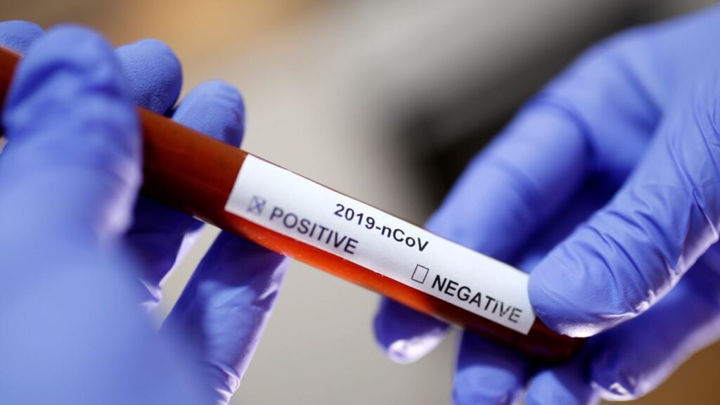 “ფორმულა”: კორონავირუსი სტიქაროსანს დაუდასტურდა