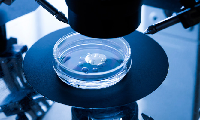 Η Ρωσική Εκκλησία μπορεί να αναθεωρήσει για την εξωσωματική