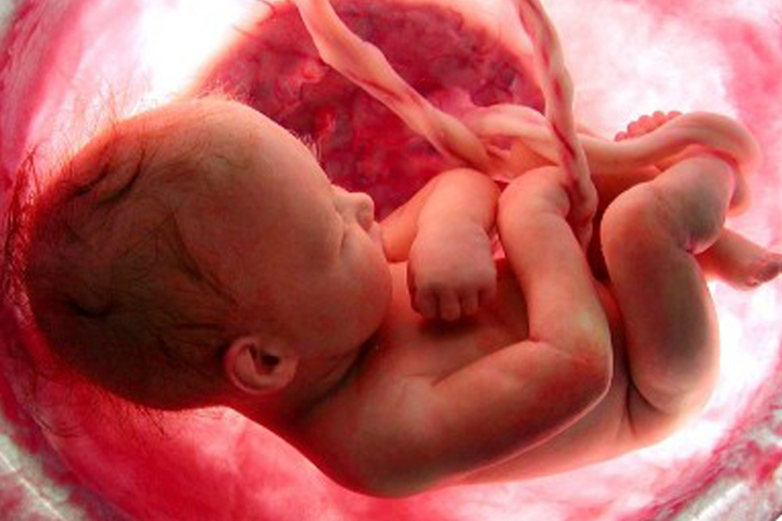 Εμβρυοκτονία με βάση το φύλο (gendercide)