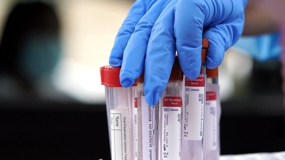 Κορωνοϊός: 229 νέα κρούσματα, 4 θάνατοι και 82 διασωληνωμένοι