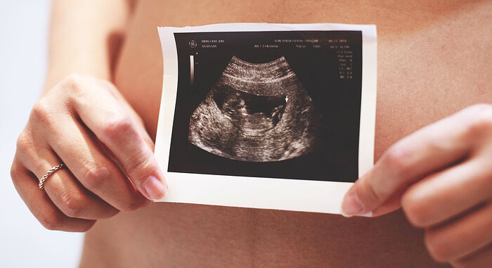 RUSSIAN CHURCH CONGRESS PROPOSES PLAN TO PHASE ABORTIONS OUT OF INSURANCE SYSTEM