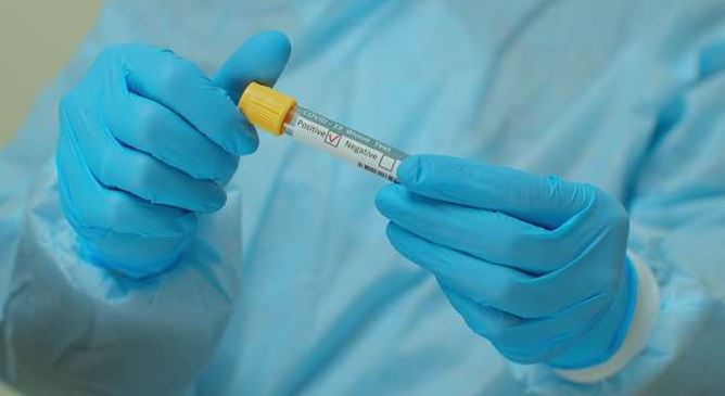 Κορονοϊός: 4.108 νέα κρούσματα, 76 θάνατοι, 590 διασωληνωμένοι