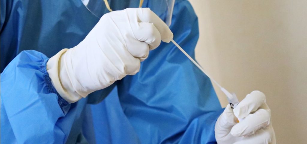 ΕΟΔΥ: Που θα γίνουν δωρεάν rapid test την Κυριακή 19 Δεκεμβρίου