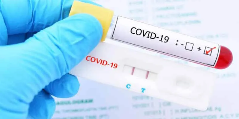 Visitors entering Greece must now present negative PCR test for Covid-19
