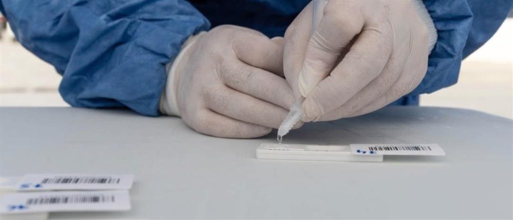 ΕΟΔΥ: Που θα γίνουν δωρεάν rapid test την Κυριακή 10 Ιουλίου