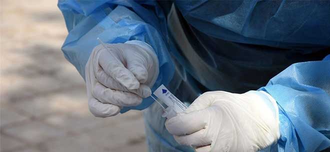 ΕΟΔΥ: Που θα γίνουν δωρεάν rapid test τη Δευτέρα 18 Ιουλίου