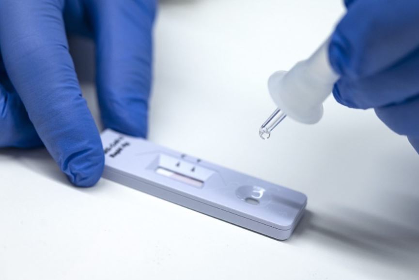 ΕΟΔΥ: Που θα γίνουν δωρεάν rapid test τη Δευτέρα 22 Αυγούστου